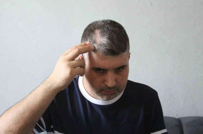 Beyzbol sopalı saldırgan dayı serbest kalınca yeğeni yardım istedi: "Can güvenliğim yok"