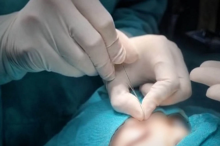 Çukurca’da gözyaşı kanalı ameliyatları yapılmaya başlandı 