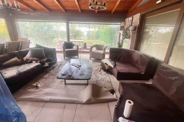 Dekoratif şömine bomba gibi patladı, vücudunun yüzde 30’u yandı: "Alev alev yanıyordum" 