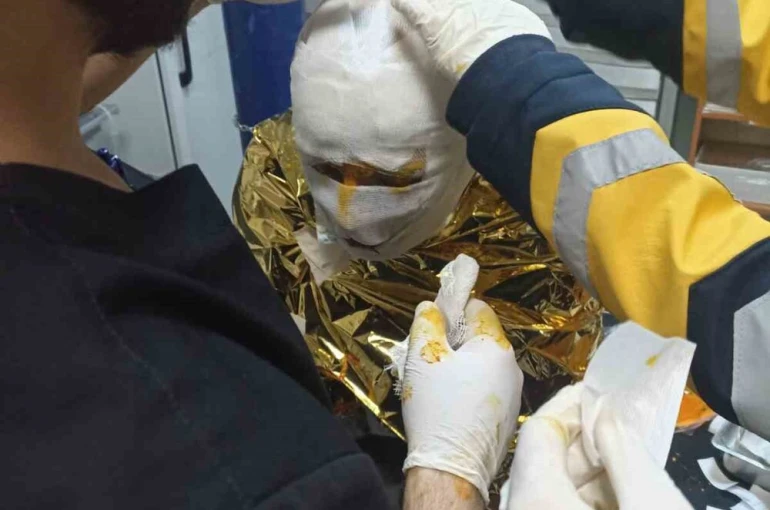 Erzincan’da kömür ocağında yangın: 2 işçi yaralı