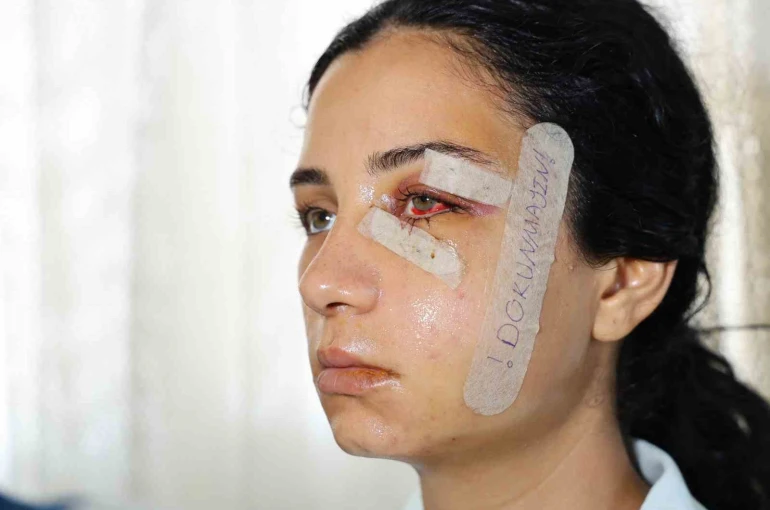 Eski eşini dövüp serbest kalan şüpheli tutuklandı 