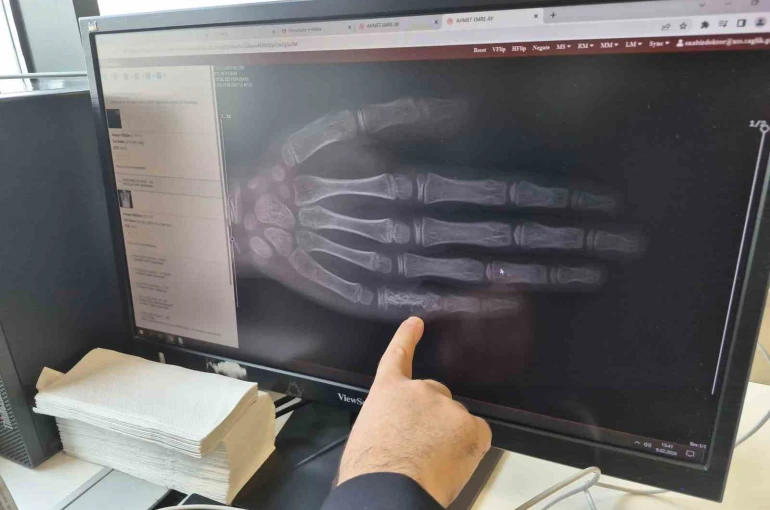 Eskişehir’de her ay 5 ila 7 çocuğa kanser tanısı konuluyor 