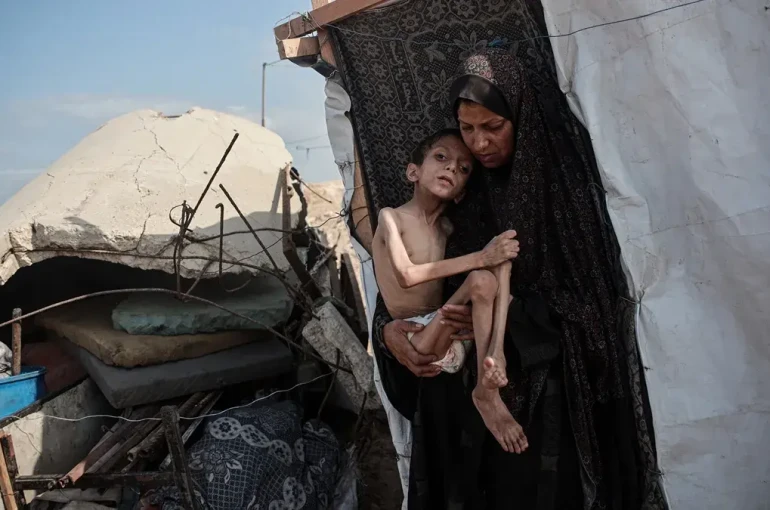 Gazze'de açlıktan ölenlerin sayısı 457'ye yükseldi