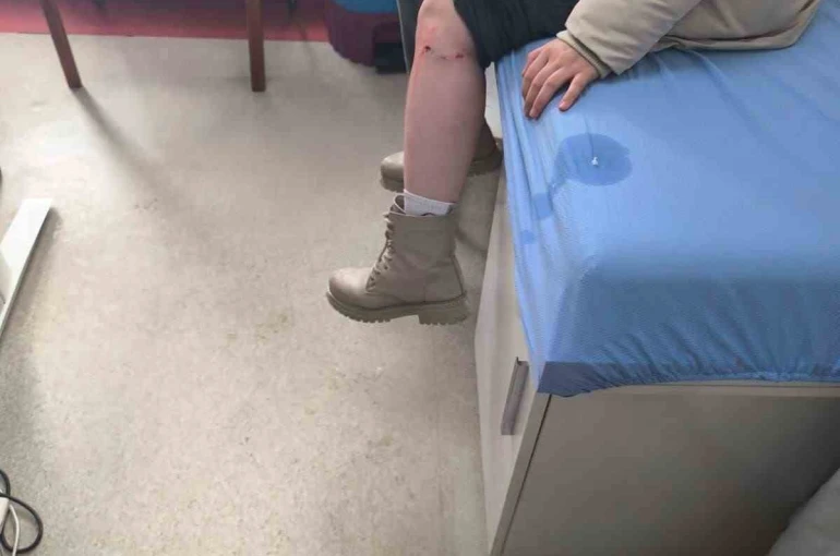 Kayseri’de sokak köpeğinin saldırısına uğrayan çocuk yaralandı 