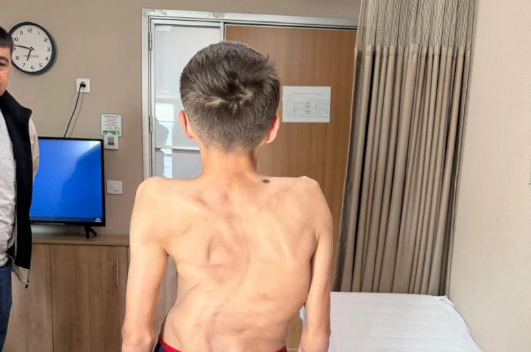 Kırgızistanlı genç şifayı Türk hekimlerinde buldu 