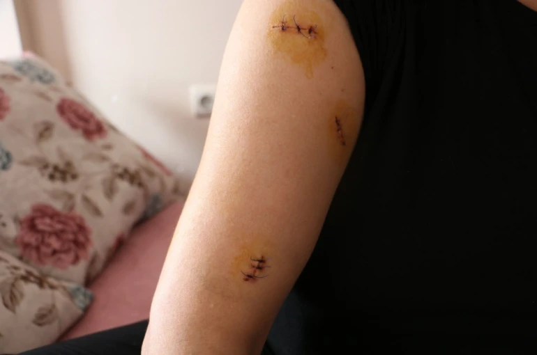 Kocası tarafından 30 yerinden bıçaklandı, görümcesi şikayetini geri çekmesini istedi 