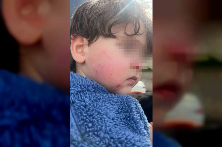 Kreşe bıraktığı çocuğunu darp edilmiş halde aldı 