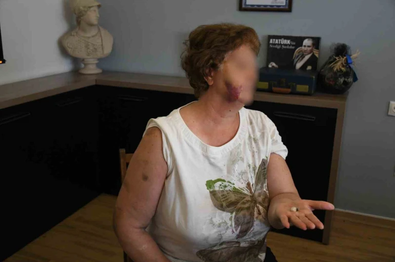 Kuşadası’nda ev kavgası kanlı bitti: Anne ve iki çocuğu bıçaklandı