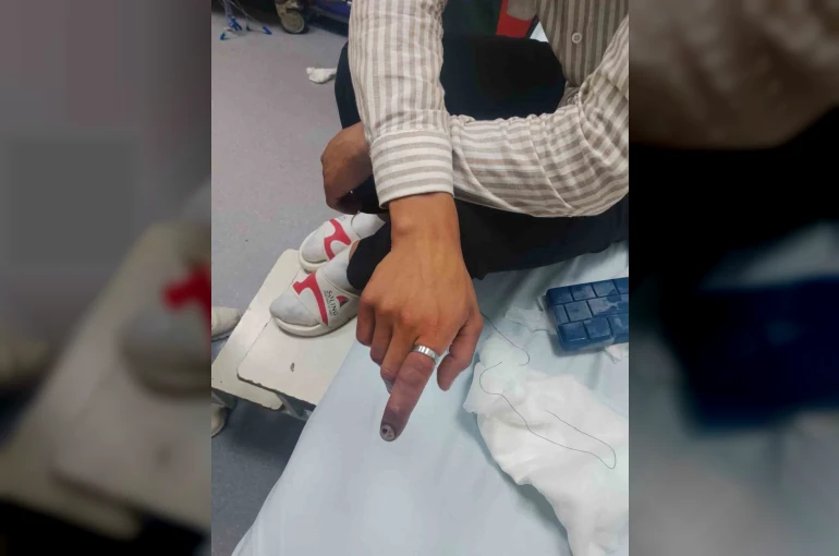 Parmağında sıkışan yüzük itfaiye ekiplerince kesildi