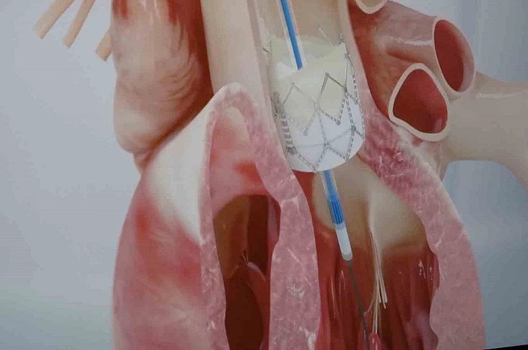 Prof. Dr. Pekdemir: "Gençlerde ani ölümlerin yüzde 90’ı genetik nedenlerden kaynaklanıyor" 