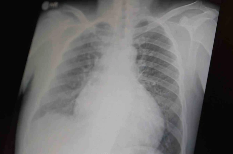 Profesör açıkladı: "Metamfetamin ve kokain gençler arasında tehlikeli boyutlara ulaştı"