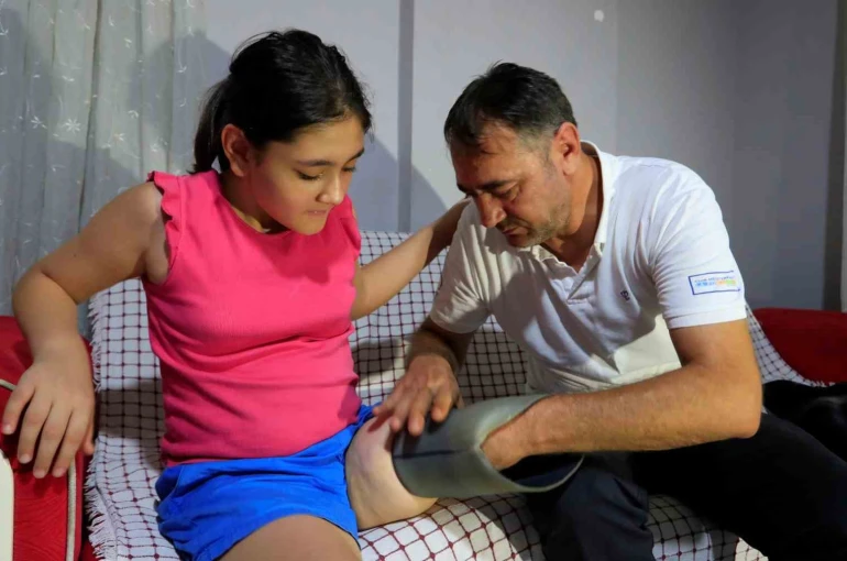 Protez bacağı dar gelen Özge için Türkiye ayağa kalktı 
