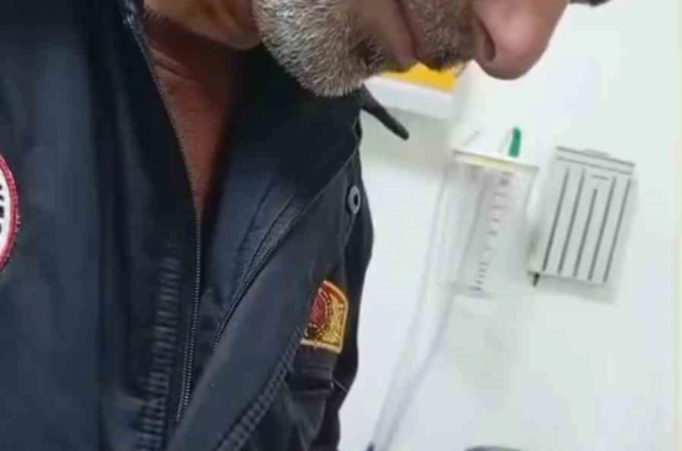 Sıkışan yüzük itfaiye ekiplerince çıkarıldı 