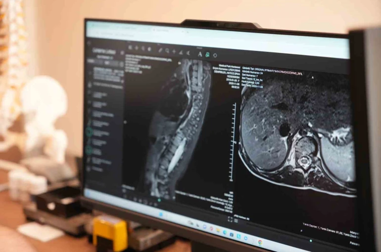 Sinsi ilerleyen bu rahatsızlığı ilk fark eden anneler oluyor 