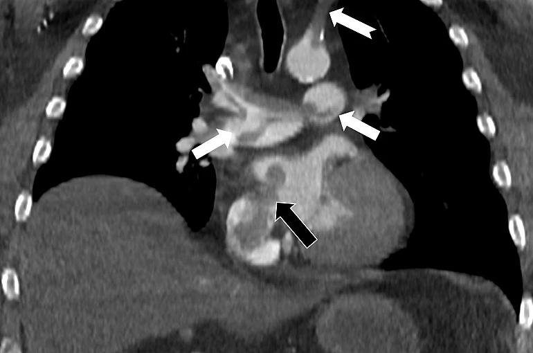 Tekden’de başarılı çalışmalara imza atan radyoloji uzmanından hayati tespit 